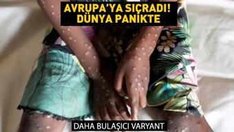 Video Haberleri | Dünyadaki maymun çiçeği korkusu yeniden tecritlere yol açacak mı? - görsel 2