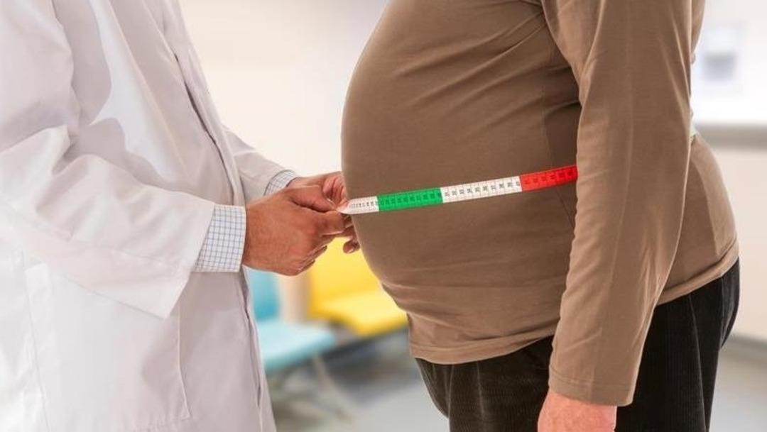 ‘Obezite ömrü 10 yıl kısaltıyor’ uyarısı! Uzmanlar: "İhtiyacı olan çok sayıda insan uygun tedaviye ulaşamıyor" - görsel 3