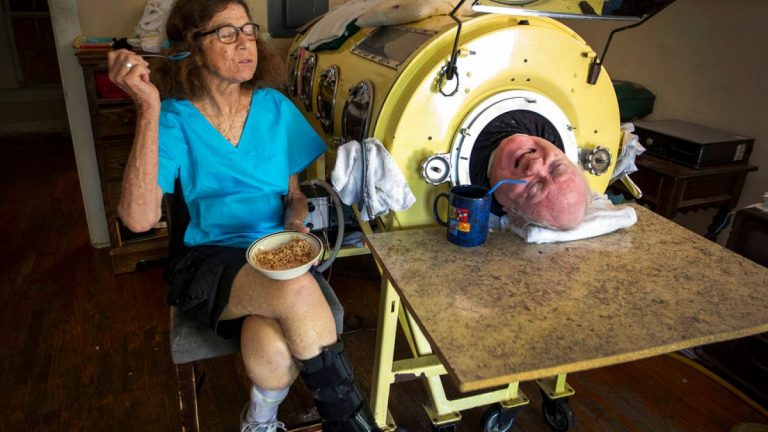 70 yıldır ‘demir akciğer’de yaşayan Paul Alexander hayatını kaybetti.